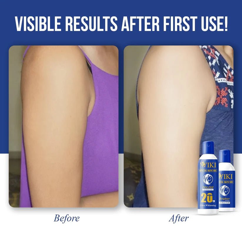 Wiki Skin Polish - Wiki Special
